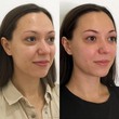 Массаж лица. Безоперационная подтяжка. - Кабинет здоровья