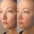 Аппаратный лифтинг массаж лица БМС  - Кабинет здоровья